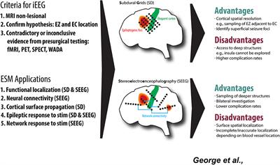 Stimulation Mapping Using <mark class="highlighted">Stereoelectroencephalography</mark>: Current and Future Directions